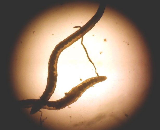 Microscopic world of water bodies