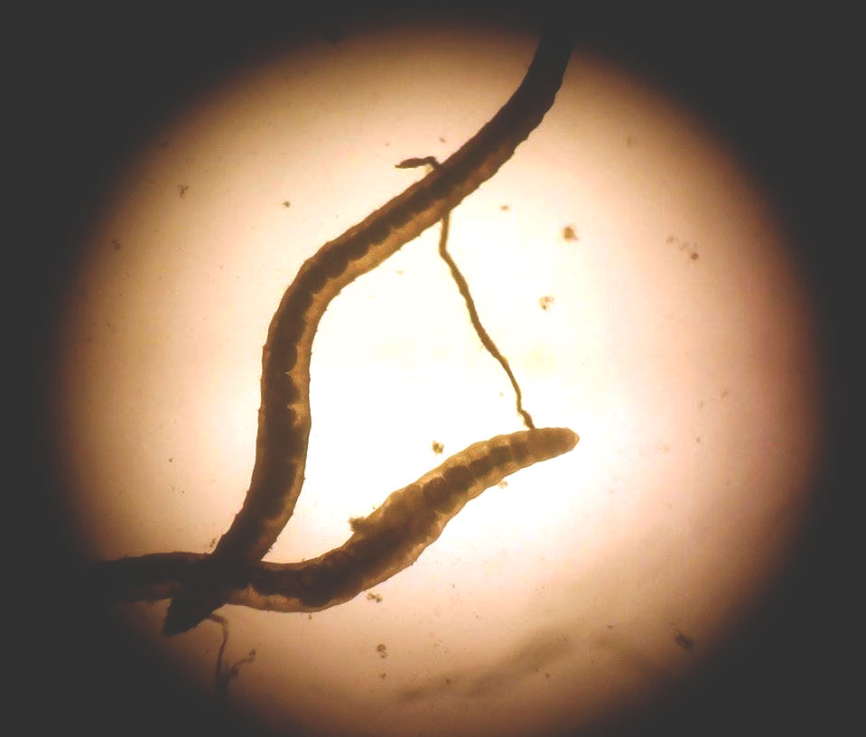 Microscopic world of water bodies